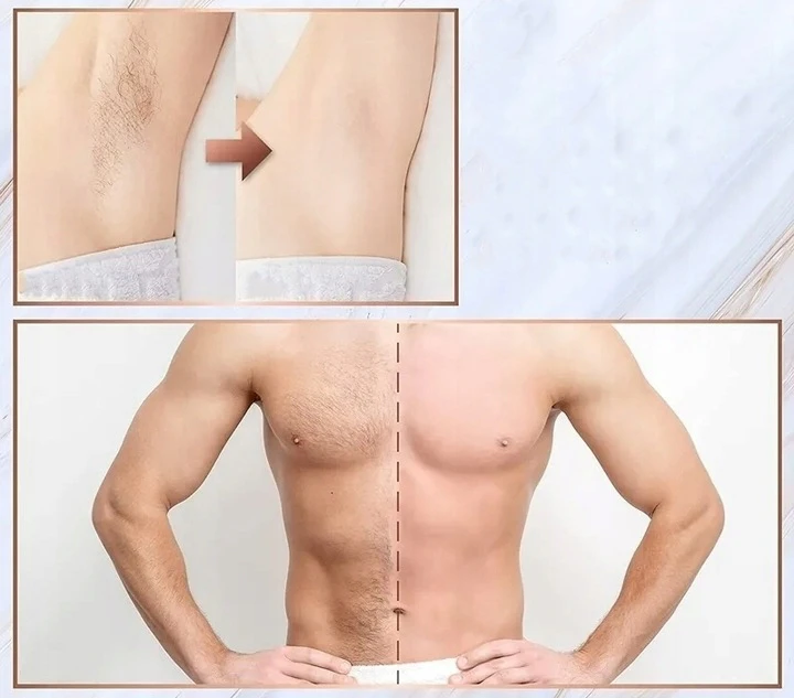 Depilator IceCool IPL Pro – 1MLN Błysków | 5 Trybów | Twarz Ciało Bikini 6